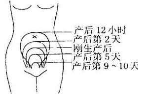 产后子宫恢复需要注意什么？